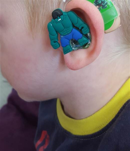 superhero-hearing-aid-kids-today-001-150707_3ee7a79bbc224d74af65ee9cc9396caa.today-inline-large