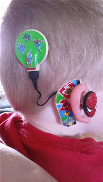 superhero-hearing-aid-kids-today-007-150707_3527e48c5c490dc2b341b3040be51bee.today-inline-large